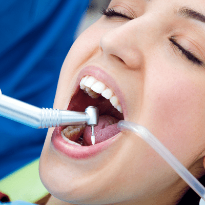 Teeth Scaling and Polishing in Islamabad, Pakistan